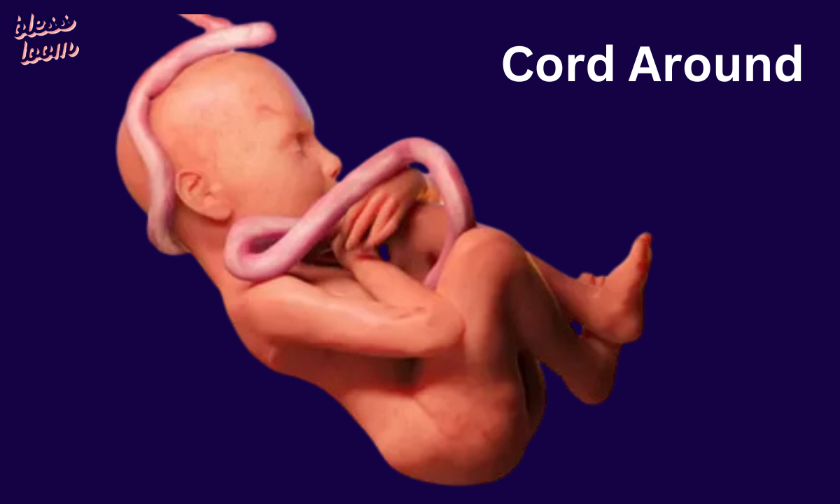 Unveiling the Spiritual Meaning of the Umbilical Cord Around the Neck at Birth